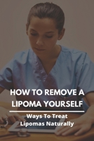How To Remove A Lipoma Yourself: Ways To Treat Lipomas Naturally: Lipomas Fatty Lumps Under The Skin B092M6J2RT Book Cover