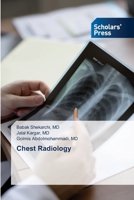 Chest Radiology 3639663713 Book Cover