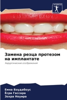 Замена резца протезом на 6206891402 Book Cover