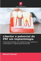 Libertar o potencial do PRF em Implantologia: Protocolos baseados em evidências para melhorar a cicatrização e a regeneração dos tecidos (Portuguese Edition) 6208817145 Book Cover