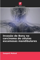 Invasão de Bony no carcinoma de células escamosas mandibulares 620528684X Book Cover