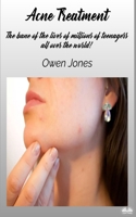 Acne Treatment: How To... 8835461006 Book Cover