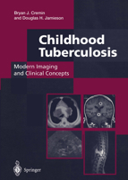Childhood Tuberculosis: Modern Imaging and Clinical Concepts 1447130138 Book Cover