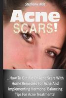 Acne Scars! ...How to Get Rid of Acne Scars with Home Remedies for Acne and Implementing Hormonal Balancing Tips for Acne Treatments! 1530439418 Book Cover