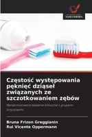 Częstośc występowania pęknięc dziąsel związanych ze szczotkowaniem zębów 6209664512 Book Cover