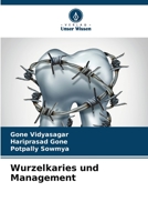 Wurzelkaries und Management 6206075281 Book Cover