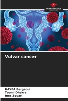 Vulvar cancer 620760024X Book Cover