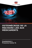 Ostéonécrose de la Mâchoire Liée Aux Médicaments (French Edition) 6209826563 Book Cover