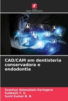 CAD/CAM em dentisteria conservadora e endodontia 6207294181 Book Cover