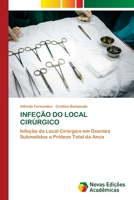 Infeção Do Local Cirúrgico (Portuguese Edition) 3639753194 Book Cover