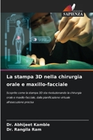 La stampa 3D nella chirurgia orale e maxillo-facciale (Italian Edition) 6208625807 Book Cover