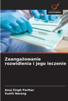 Zaangażowanie rozwidlenia i jego leczenie 6209267351 Book Cover