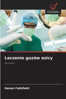Leczenie guzów esicy (Polish Edition) 6209546943 Book Cover
