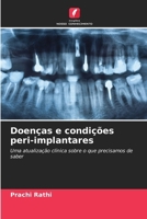 Doenças e condições peri-implantares (Portuguese Edition) 6207497651 Book Cover