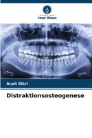 Distraktionsosteogenese (German Edition) 6207876431 Book Cover