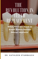 The Revolution in Teeth Replacement: What Patients Need to Know Before Having Dental Implants B0BB618YZH Book Cover