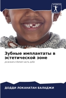 &#1047;&#1091;&#1073;&#1085;&#1099;&#1077; &#1080;&#1084;&#1087;&#1083;&#1072;&#1085;&#1090;&#1072;&#1090;&#1099; &#1074; &#1101;&#1089;&#1090;&#1077; 6205653907 Book Cover