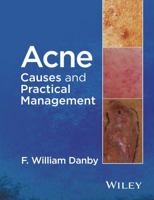 Acne: Causes and Practical Management 1118232771 Book Cover