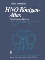 Hno Rontgen-Atlas: Pathologische Befunde 3642692427 Book Cover