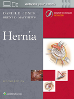 Master Techniques in Surgery: Hernia: Print + eBook with Multimedia 1975222296 Book Cover