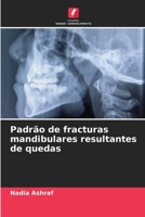 Padrão de fracturas mandibulares resultantes de quedas (Portuguese Edition) 6207782097 Book Cover