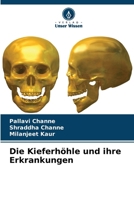 Die Kieferhöhle und ihre Erkrankungen (German Edition) 6209724310 Book Cover