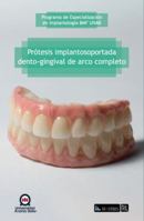 Prótesis implantosoportada dento-gingival de arco completo (Spanish Edition) 9560115723 Book Cover
