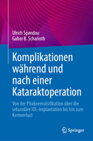 Komplikationen während und nach einer Kataraktoperation: Von der Phakoemulsifikation über die sekundäre IOL-Implantation bis hin zum Kernverlust 3031459830 Book Cover