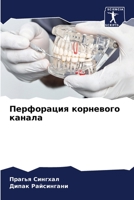 Перфорация корневого ка& 6205688719 Book Cover