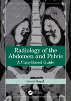 Radiology of the Abdomen and Pelvis: A Case-Based Guide 1032587741 Book Cover