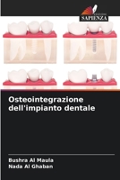 Osteointegrazione dell'impianto dentale (Italian Edition) 6208060591 Book Cover