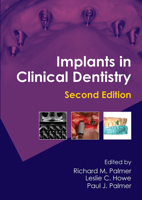 Implants in Clinical Dentistry 1841849065 Book Cover