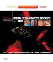 Atlas of Sexually Transmitted Diseases and AIDS 0723421439 Book Cover