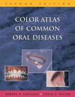 Color Atlas of Common Oral Diseases