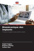 Biomécanique des implants: Principes d'ingénierie des systèmes vivants 6206137775 Book Cover