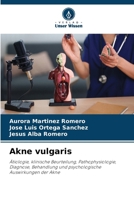 Akne vulgaris (German Edition) 6630353552 Book Cover