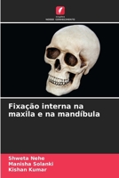 Fixação interna na maxila e na mandíbula (Portuguese Edition) 620886724X Book Cover