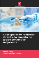 A recuperação radicular através do enxerto de tecido conjuntivo subjacente (Portuguese Edition) 6630445716 Book Cover