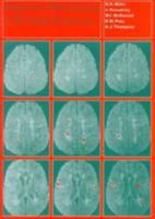 Magnetic Resonance in Multiple Sclerosis 052147325X Book Cover