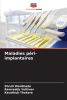 Maladies péri-implantaires 6205797917 Book Cover