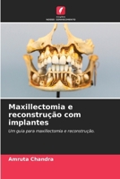 Maxillectomia e reconstrução com implantes (Portuguese Edition) 6200084513 Book Cover