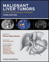 Malignant Liver Tumors: Current and Emerging Therapies 0763718572 Book Cover