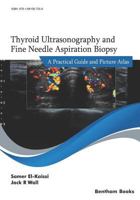 Thyroid Ultrasonography and Fine Needle Aspiration Biopsy: A Practical Guide and Picture Atlas 1681087553 Book Cover