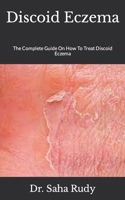 Discoid Eczema: The Complete Guide On How To Treat Discoid Eczema null Book Cover