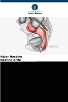 Präkanzeröse Läsionen des Anus 6209110991 Book Cover