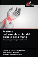 Fratture dell'avambraccio, del polso e della mano 6203332682 Book Cover