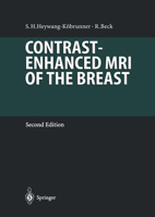 Contrast-Enhanced MRI of the Breast 3642646298 Book Cover