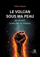 Le volcan sous ma peau: Ma vie avec la maladie de Verneuil B0GWLTH3WC Book Cover