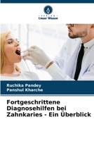 Fortgeschrittene Diagnosehilfen bei Zahnkaries - Ein Überblick 6206299813 Book Cover