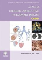 Atlas of Chronic Obstructive Pulmonary Disease 1842140043 Book Cover